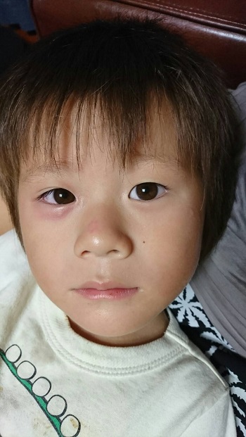 5日・インフル6日目!