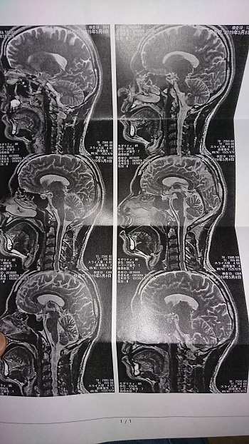 8日・人生初のMRI!