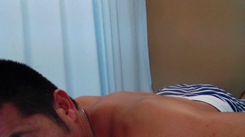 20日・粉瘤(アテローム)の手術をして来ました!