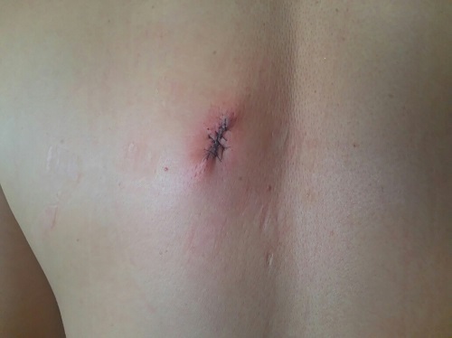 22日・沖縄の梅雨が明けました!